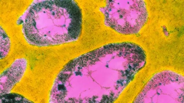 Francisella tularensis bacteria. © Science Photo Library