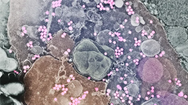 Yellow fever virus particles, TEM. © Science Photo Library