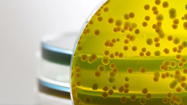 Image of shigella test