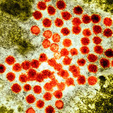 Hepatitis-A_H Thumbnail