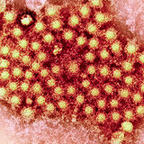 Hepatitis-C_H Thumbnail