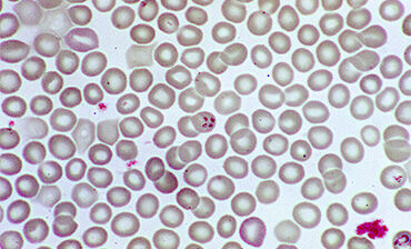 Babesia sp. Trophozoites. Credit: CDC/ Dr. Mae Melvin