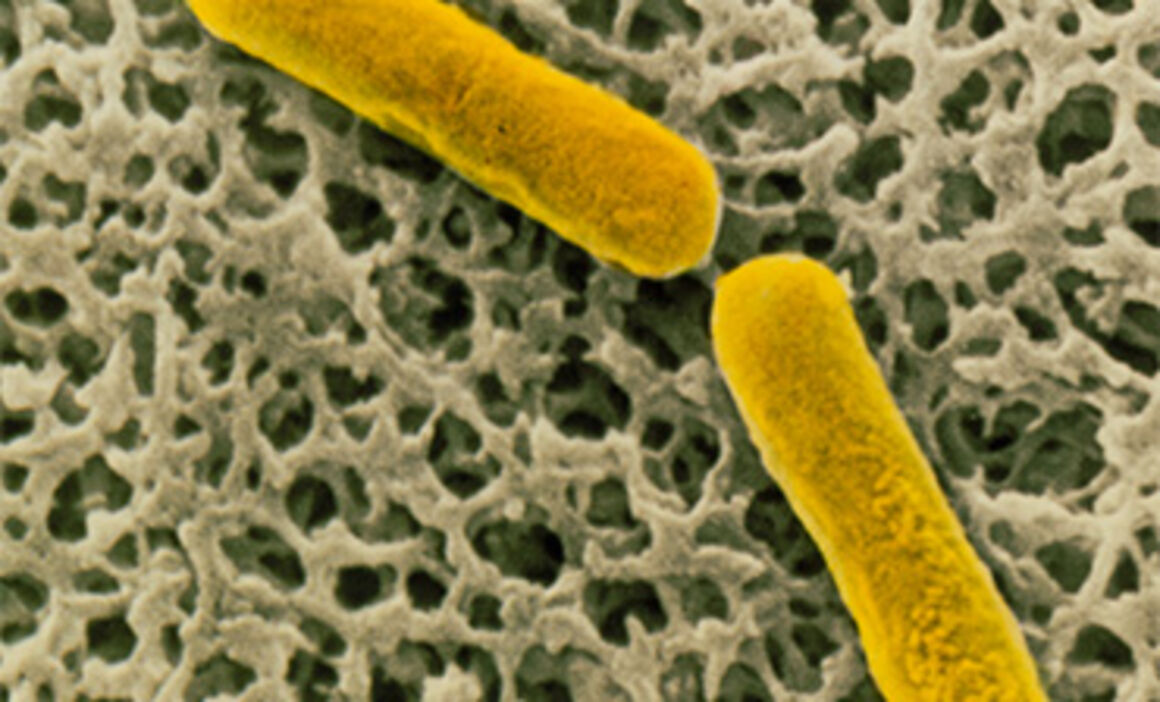 Clostridium botulinum bacteria. © Science Photo Library