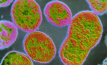 f/Colour TEM of Brucella abortus bacteria. © Science Photo Library