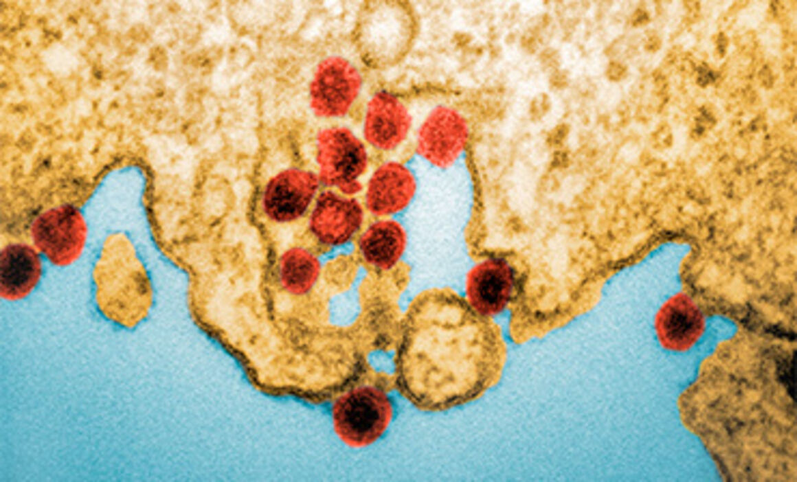 Chikungunya virus particles. © Science Photo Library