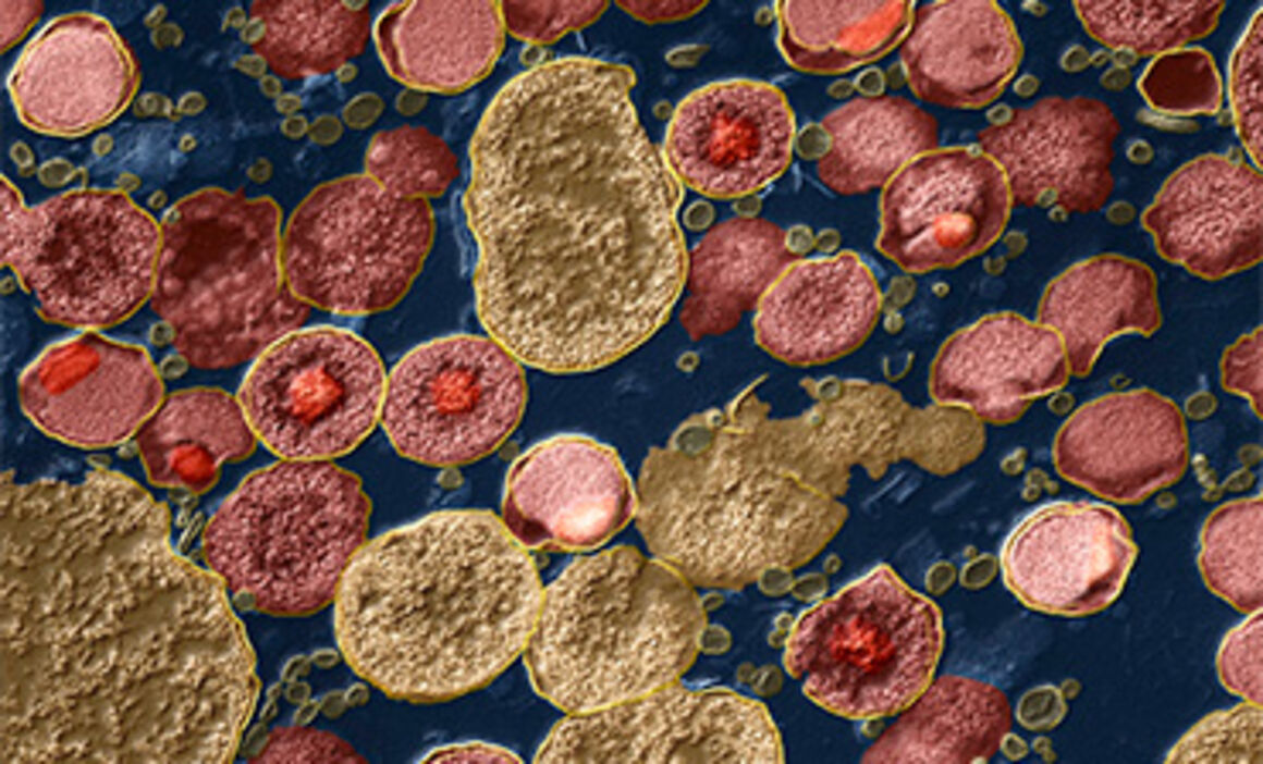 Chlamydia trachomatis bacteria, TEM. © Science Photo Library