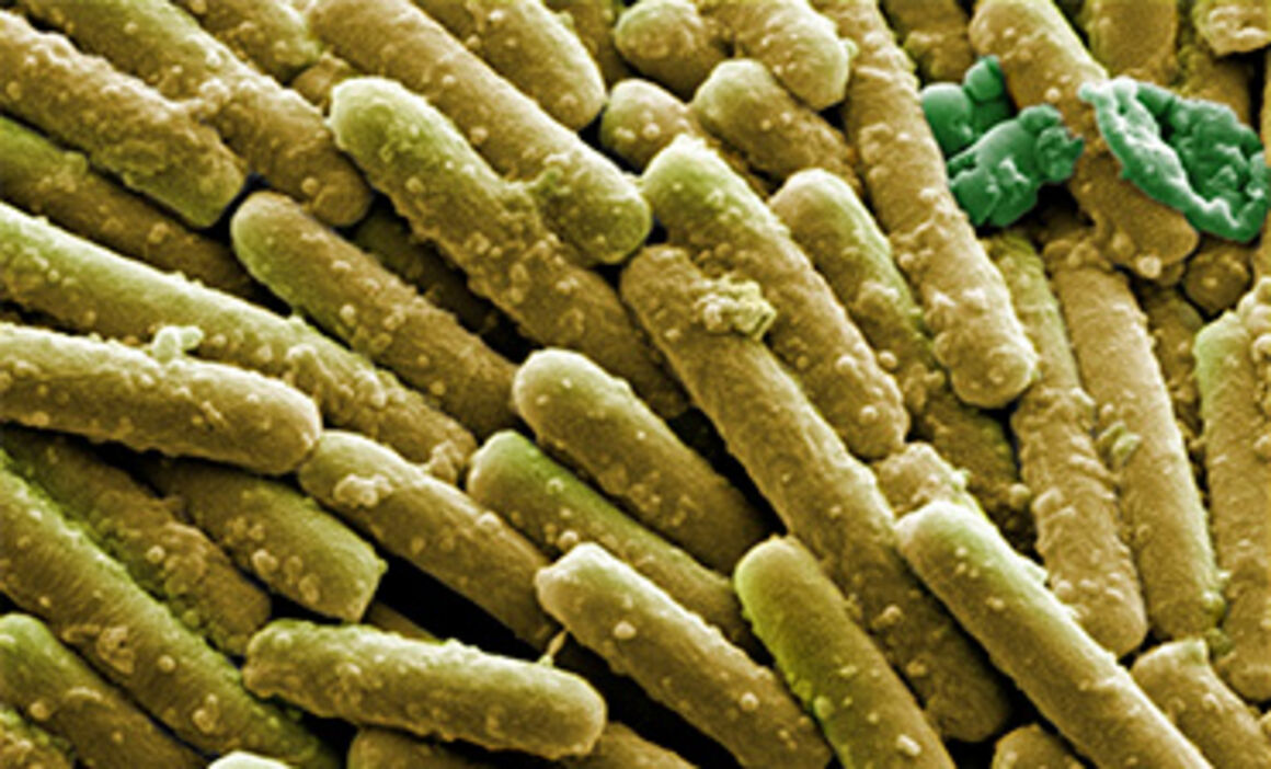 Clostridium difficile bacteria, SEM. © Science Photo Library