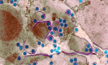 Dengue fever virus particles, TEM. © Science Photo Library