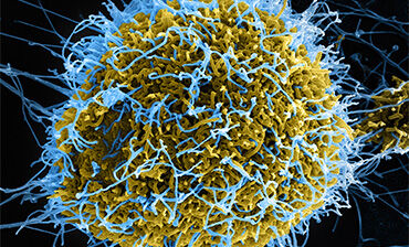 Ebola virus particles. Credit: NIAID