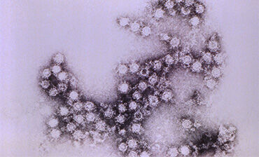 Morphologic traits of the Coxsackie B4 virus virions. Credit: CDC