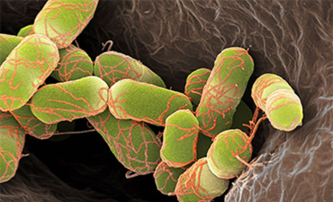 Escherichia coli bacteria, SEM. © Science Photo Library