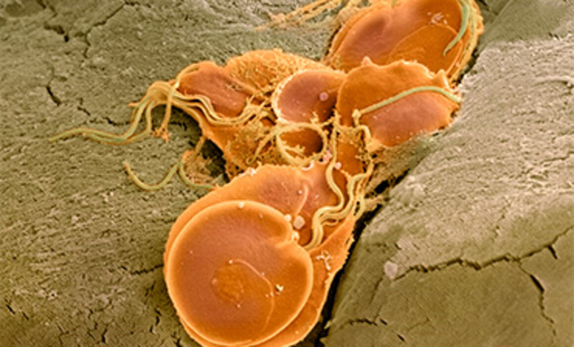 Giardia lamblia protozoa, SEM. © Science Photo Library