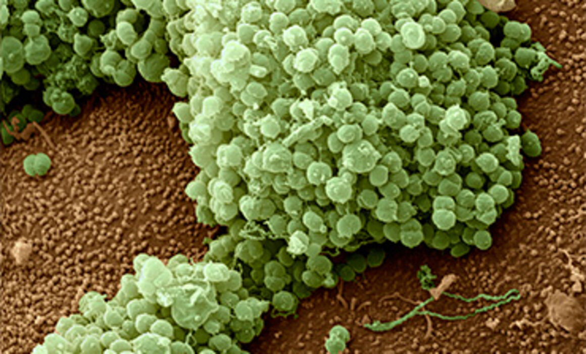 Gonorrhoea bacteria, SEM. © Science Photo Library