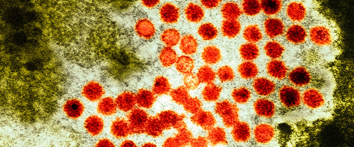 Hepatitis A virus particles, TEM. © Science Photo Library