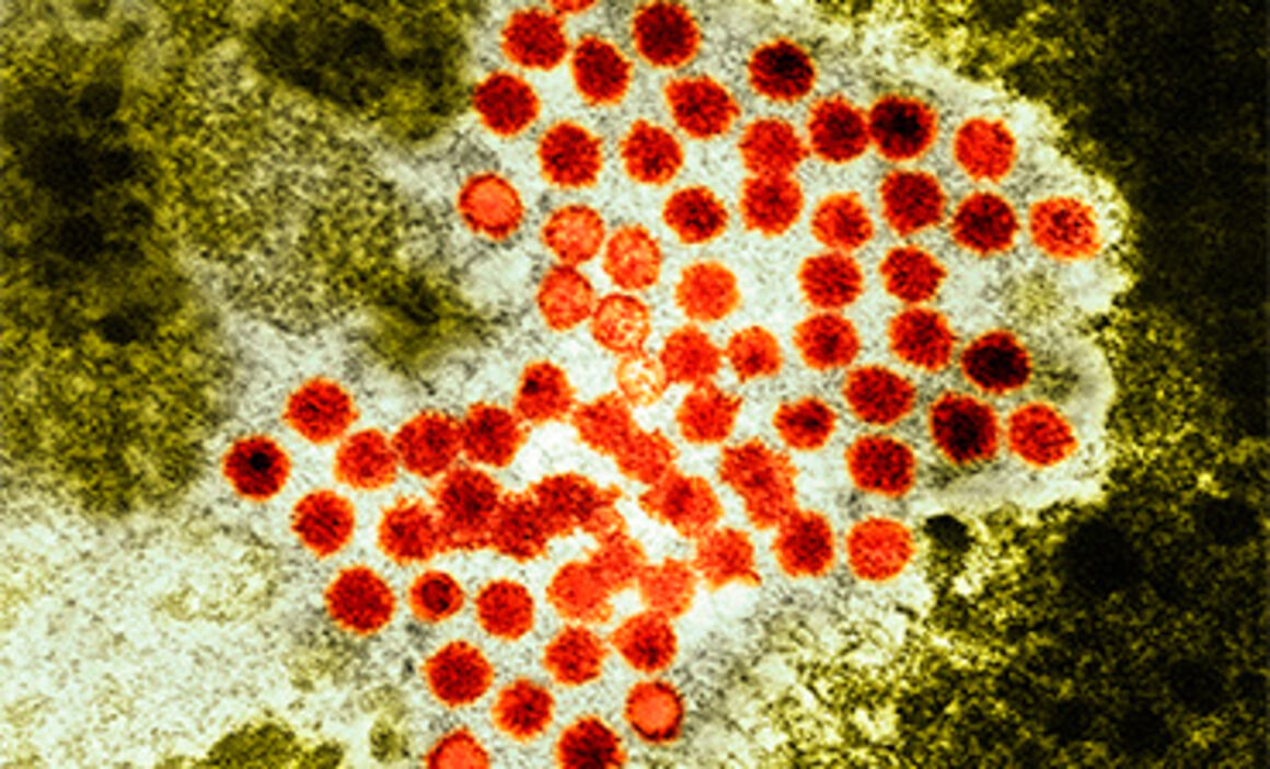 Hepatitis A virus particles, TEM. © Science Photo Library