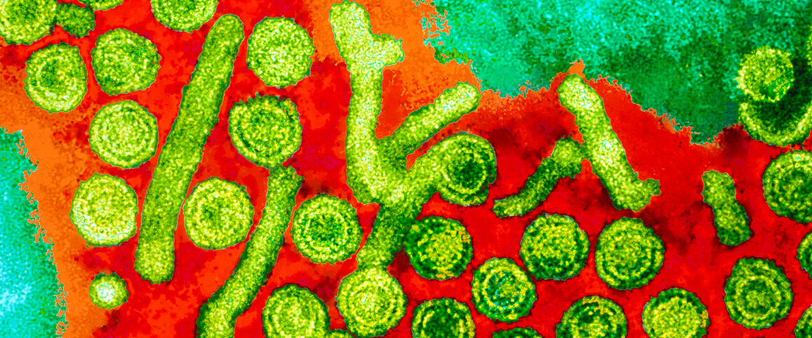 Hepatitis B viruses, TEM. © Science Photo Library