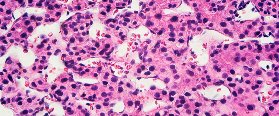 Hepatitis virus particles, TEM. © Science Photo Library