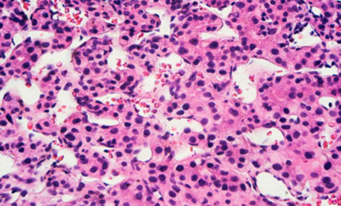 Hepatitis virus particles, TEM. © Science Photo Library