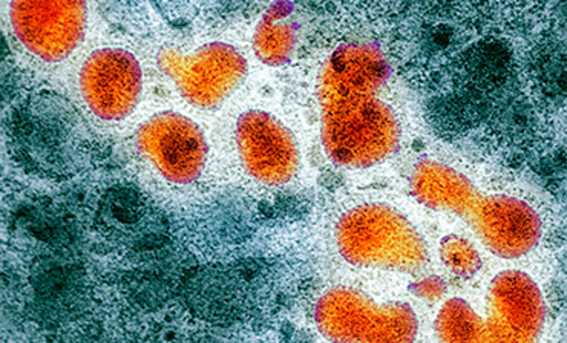 H5N1 avian influenza virus particles, TEM. © Science Photo Library