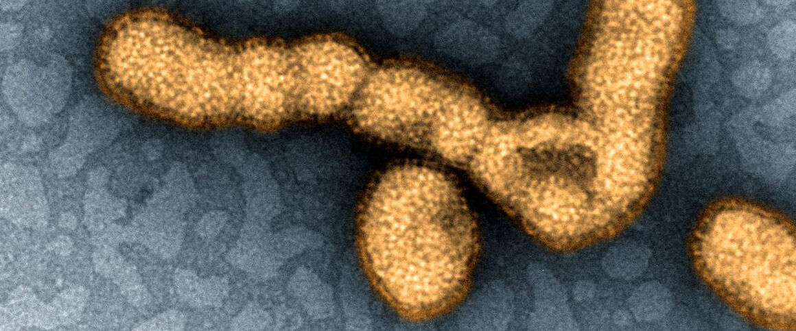 H1N1 Influenza virus particles. Credit: NIAID