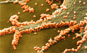 H1N1 flu virus particles, SEM. © Science Photo Library