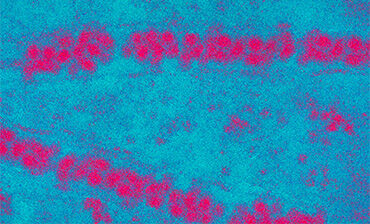 Japanese encephalitis virus (Flavivirus). Credit: Sanofi Pasteur