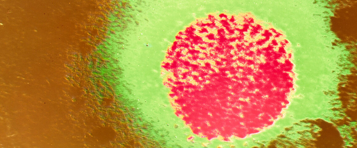 Coloured TEM of Lassa fever virus. © Science Photo Library
