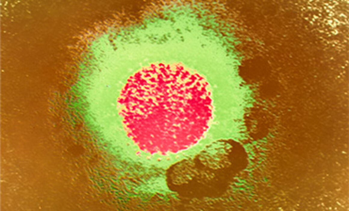 Coloured TEM of Lassa fever virus. © Science Photo Library
