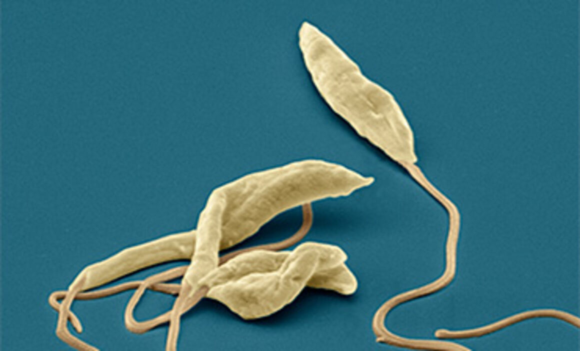 Leishmania parasites, SEM. © Science Photo Library