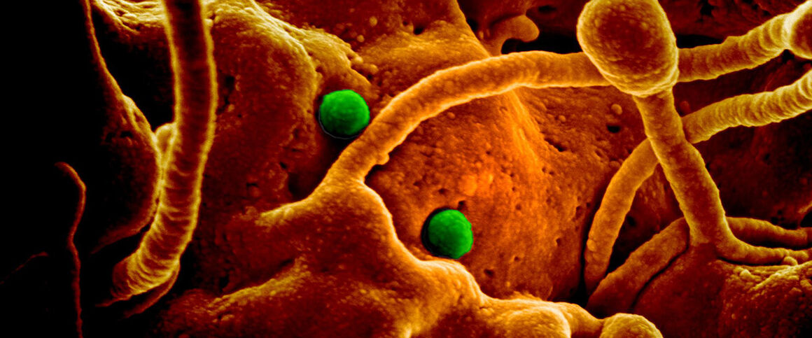 MERS-CoV particles on camel epithelial cells. Credit: NIAID