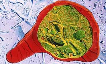 TEM of blood cell with malaria. © Science Photo Library