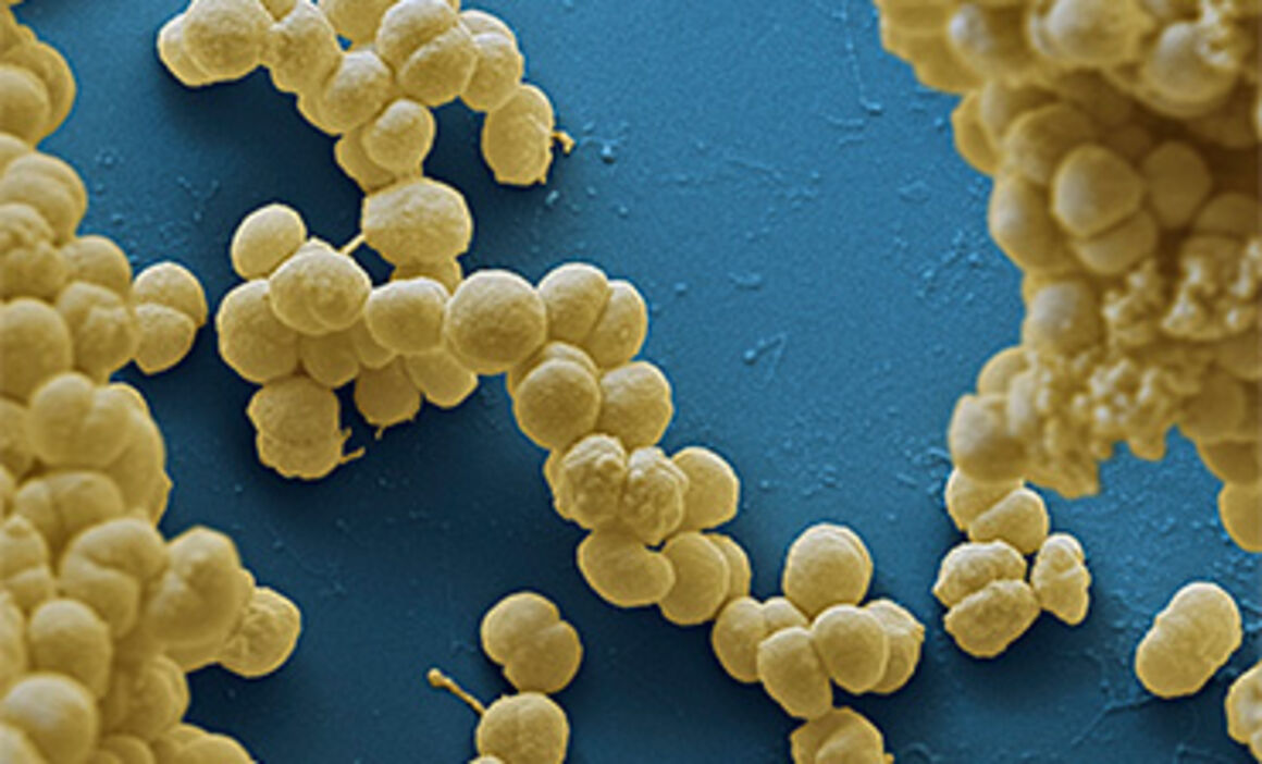 Meningitis bacteria, SEM. © Science Photo Library