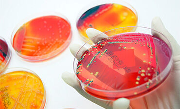 Bacteria in Petri dish. © Istock