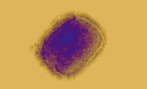 MPox (Orthopox Virus) Baltimore City Health Department