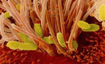 Bordetella pertussis bacteria in trachea. © Science Photo Library