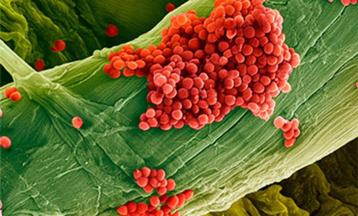 Streptococcus pneumoniae bacteria, SEM. © Science Photo Library