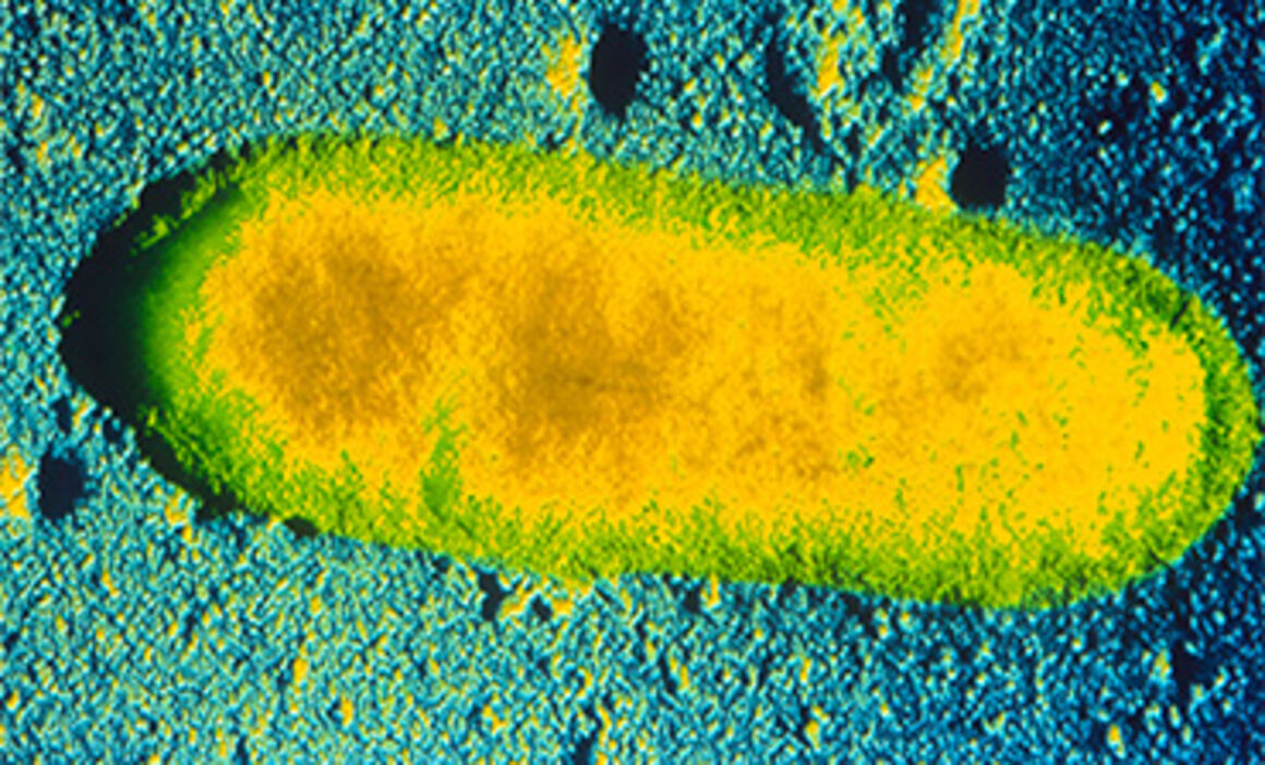 Coloured TEM of Rickettsiae bacterium. © Science Photo Library