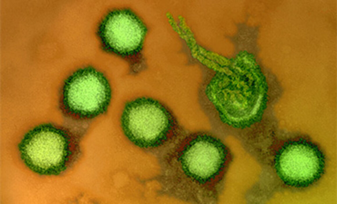Rift Valley fever virus, TEM. © Science Photo Library
