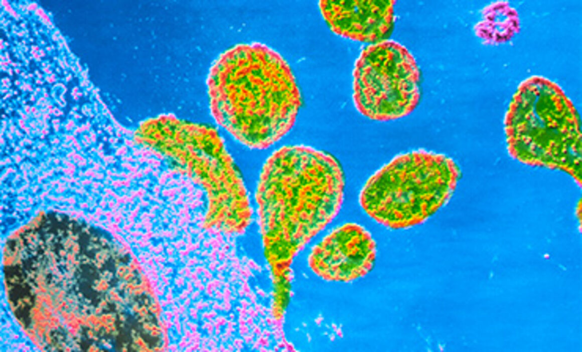 TEM of Rubella viruses. © Science Photo Library