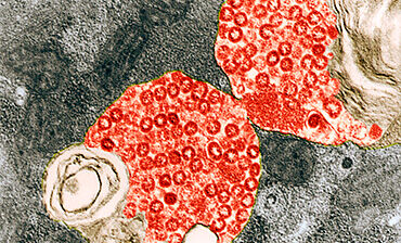 SARS virus particles, TEM. © Science Photo Library