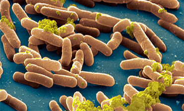 Salmonella typhimurium bacteria. © Science Photo Library