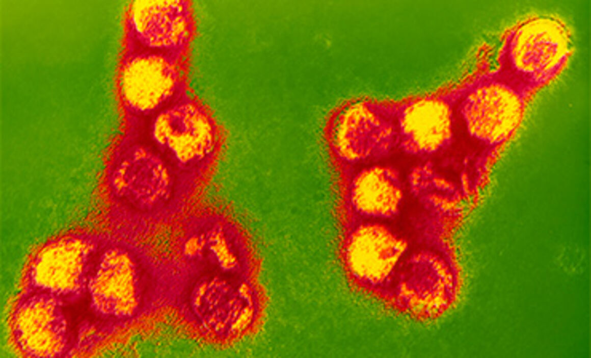 Coloured TEM of tick-borne encephalitis virus. © Science Photo Library