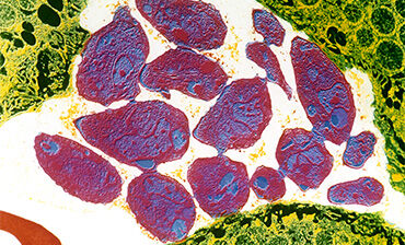 Toxoplasmosis. © Science Photo Library