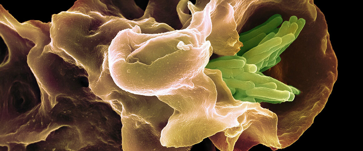 Macrophage engulfing TB bacteria, SEM. © Science Photo Library