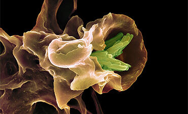 Macrophage engulfing TB bacteria, SEM. © Science Photo Library