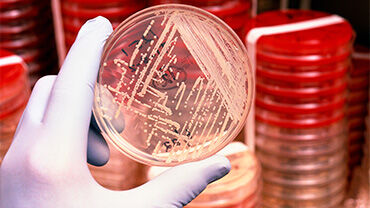 Antibiotic resistant bacteria. © Science Photo Library