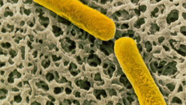 Clostridium botulinum bacteria. © Science Photo Library