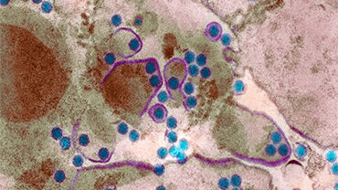 Dengue fever virus particles, TEM. © Science Photo Library