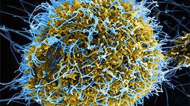 Ebola virus particles. Credit: NIAID