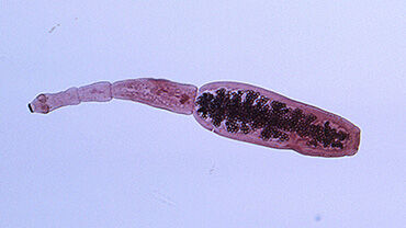 Echinococcus granulosus. Credit: CDC/ Dr.Peter Schantz